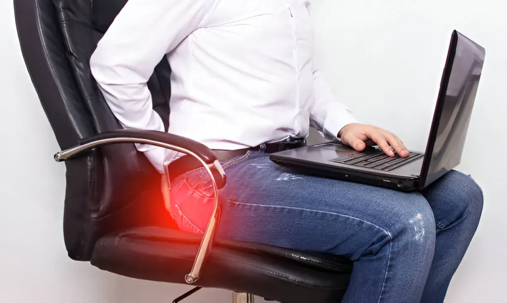 Hemorrhoids (Piles): What You Need to Know About Causes and Treatments