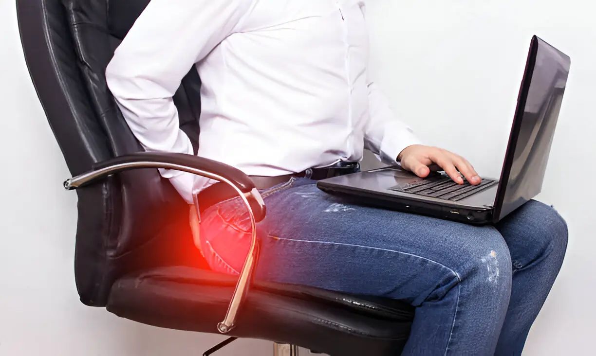 Hemorrhoids (Piles): What You Need to Know About Causes and Treatments