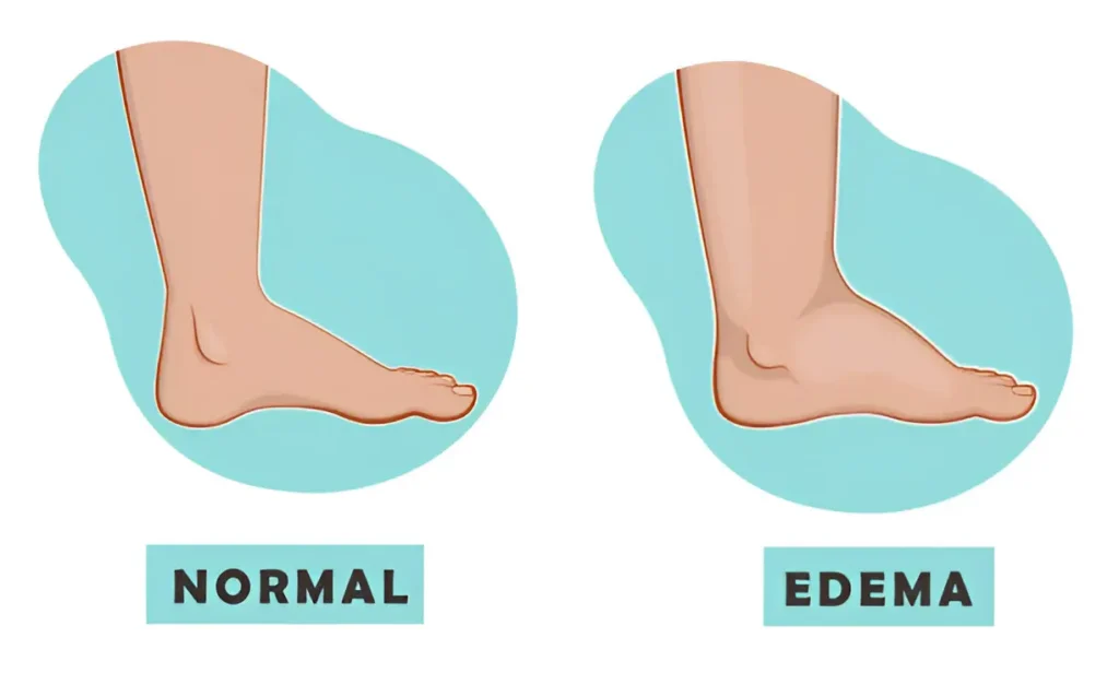 Types of Foot Deformities and How They Affect Daily Life